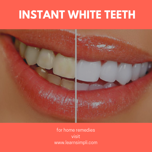 Home remedy to get instant white teeth.