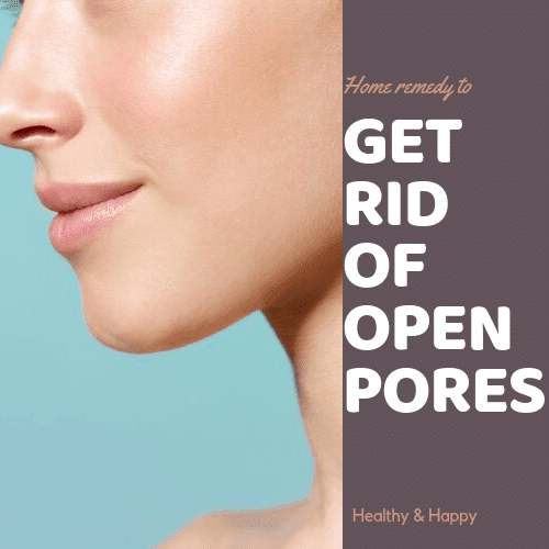 get rid of open pores from face